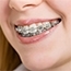 Orthodontics